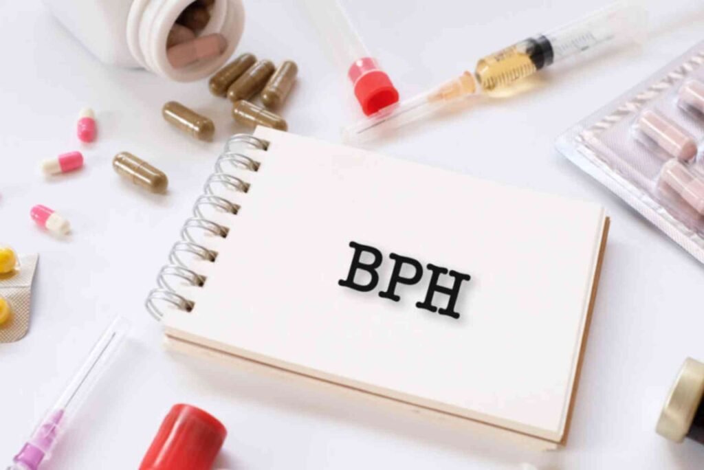 Best What Are The Latest Treatments For BPH For Beginners